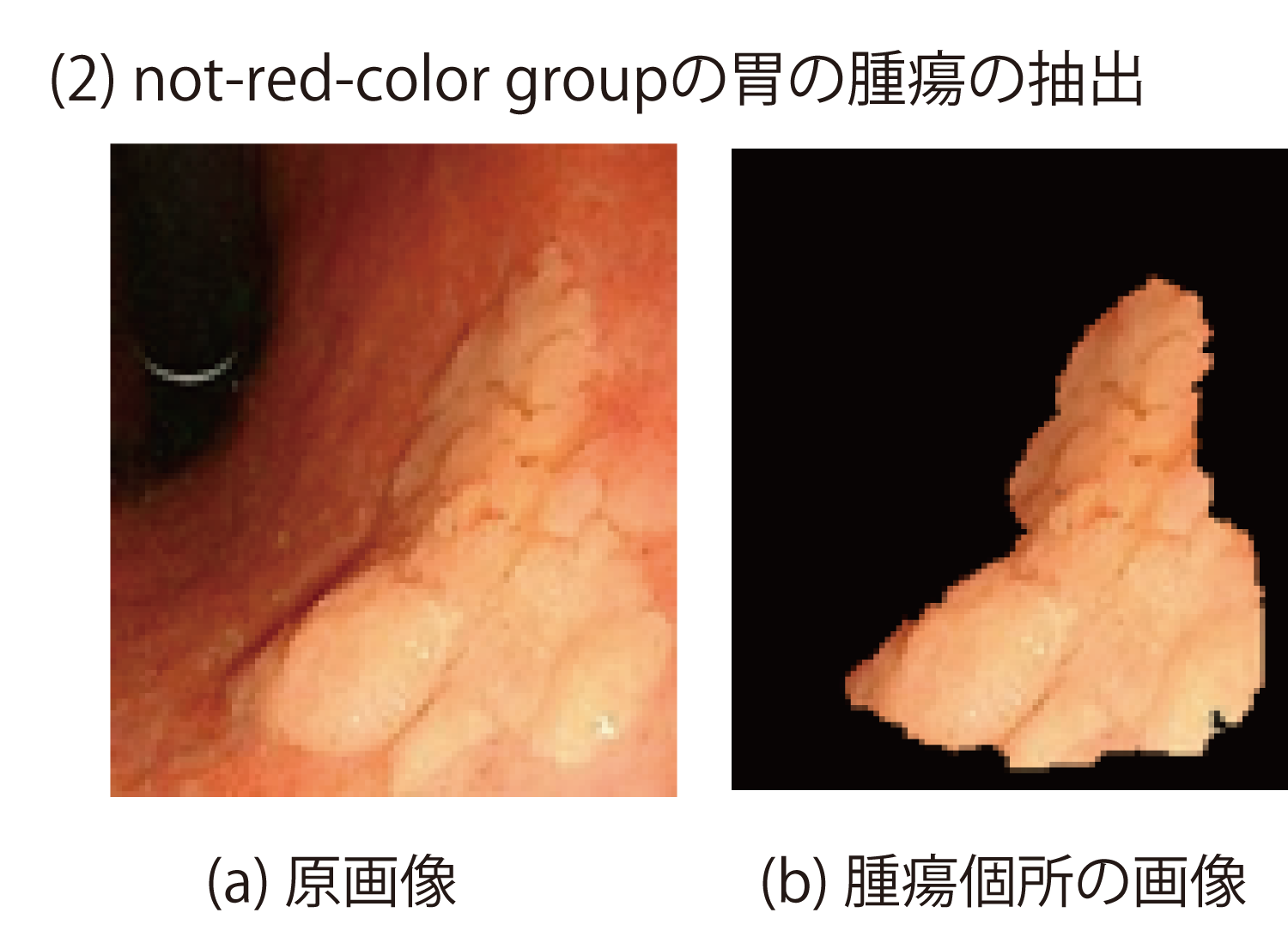 図11