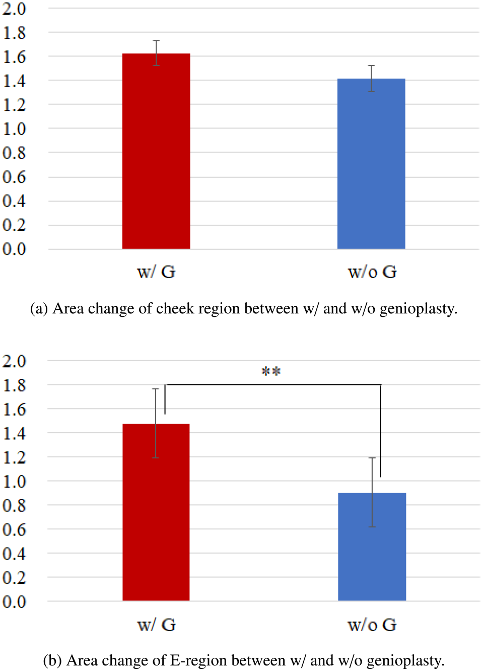 Effect of genioplasty on the area change of face regions [7].