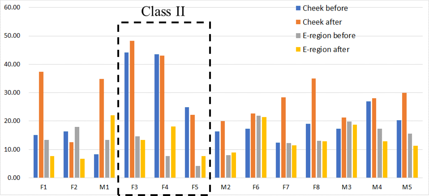 Examples of visualized volumes of soft tissues for both Class II and III [6].