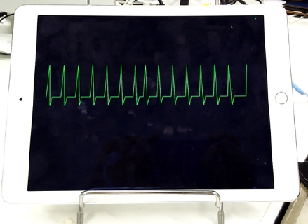 模擬心電図　Mock ECG.